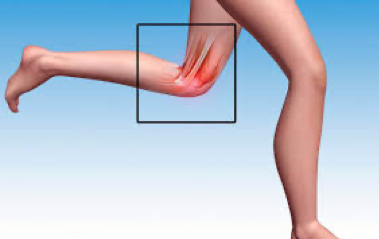 Síndrome pota de ganso