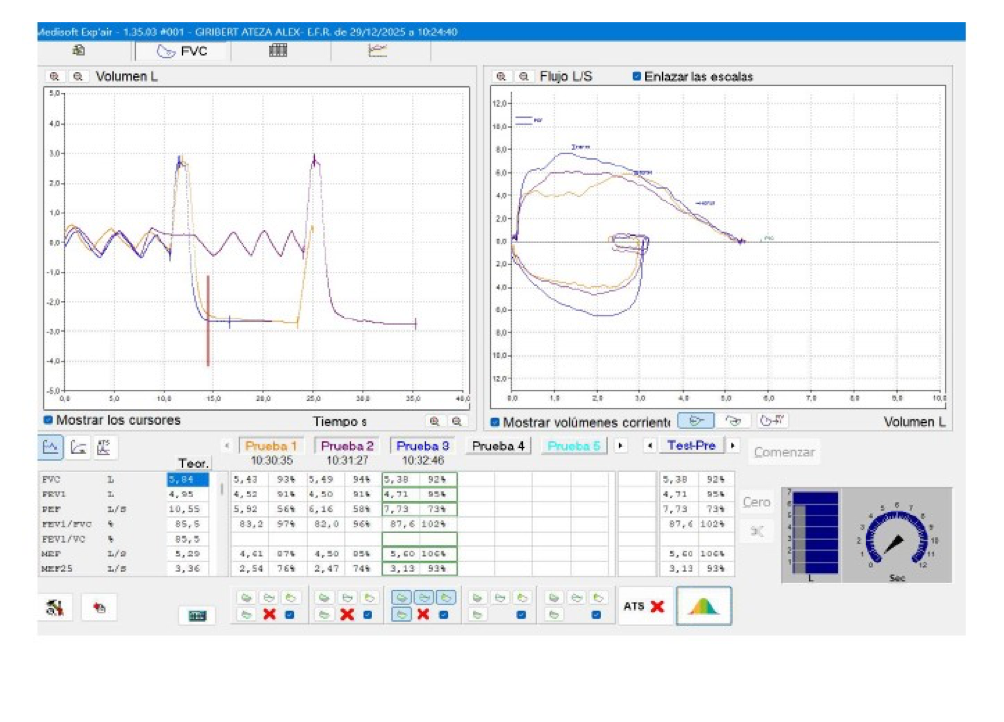 grafica espirometria